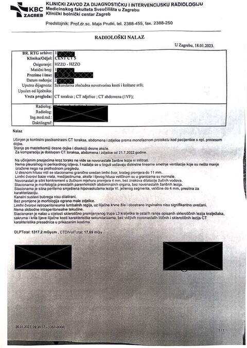 Nalaz — Sekundarna zloćudna novotvorina kosti i koštane srži (anonimizirano)