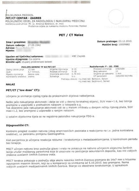 Nalaz — Zloćudni tumor pluća (anonimizirano)