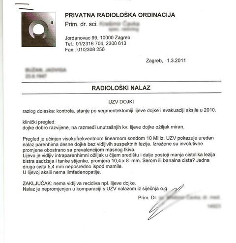 Nalaz — Zloćudni tumor lijeve dojke (anonimizirano)