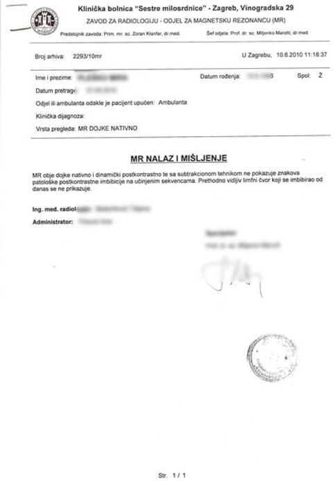 Nalaz — Zloćudni tumor mozga (anonimizirano)
