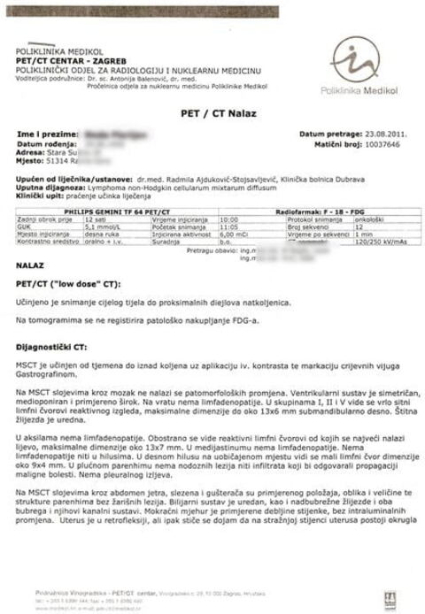 Nalaz — Zloćudni tumor lymphonz non Hodkin (anonimizirano)