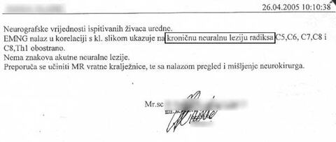 Nalaz — Neuralna leksija radiksa (anonimizirano)