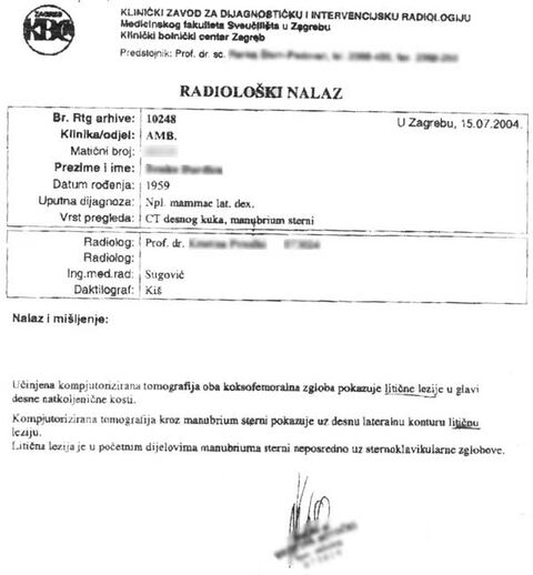 Nalaz — Zloćudni tumor glave natkoljenične kosti (anonimizirano)
